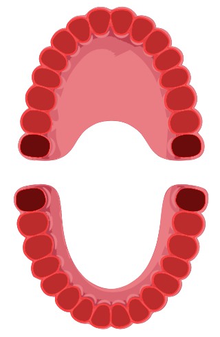 In assenza di impianti